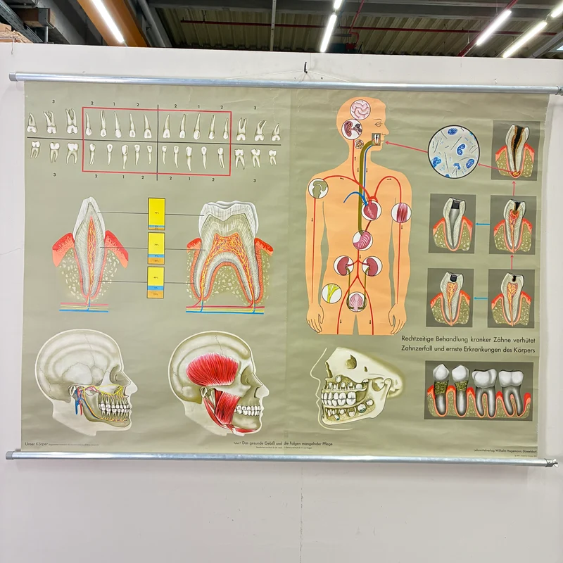 Vintage Schulkarte – Das Gebiss – Hagemann Biologie Medizin Lehrtafel Rollbild Gebraucht