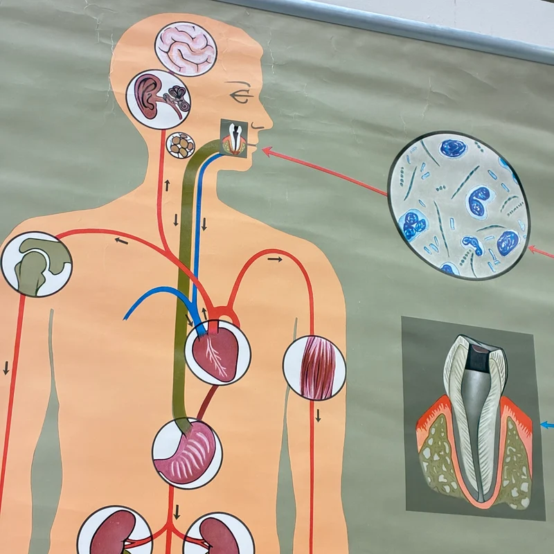 Vintage Schulkarte – Das Gebiss – Hagemann Biologie Medizin Lehrtafel Rollbild Gebraucht