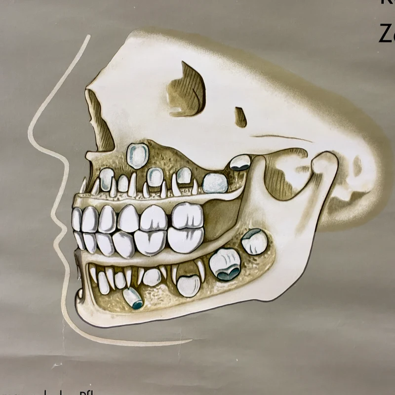 Vintage Schulkarte – Das Gebiss – Hagemann Biologie Medizin Lehrtafel Rollbild Gebraucht