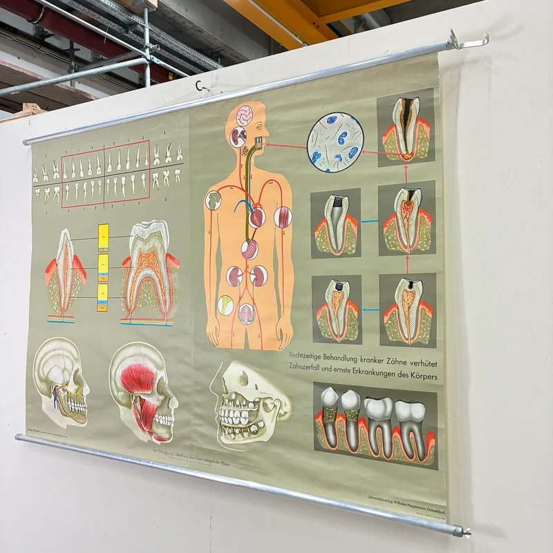 Vintage Schulkarte – Das Gebiss – Hagemann Biologie Medizin Lehrtafel Rollbild Gebraucht