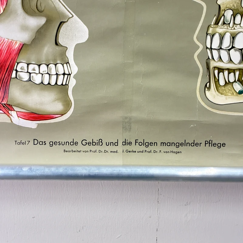 Vintage Schulkarte – Das Gebiss – Hagemann Biologie Medizin Lehrtafel Rollbild Gebraucht