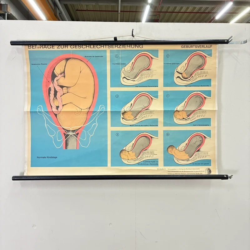 Vintage Schulkarte – Geburtsverlauf – Biologie Lehrtafel Rollbild Gebraucht
