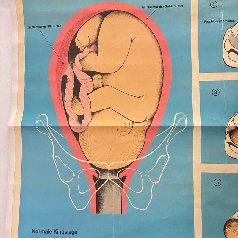 Vintage Schulkarte – Geburtsverlauf – Biologie Lehrtafel Rollbild Gebraucht