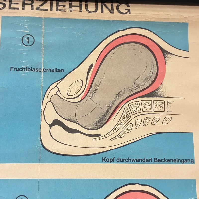 Vintage Schulkarte – Geburtsverlauf – Biologie Lehrtafel Rollbild Gebraucht