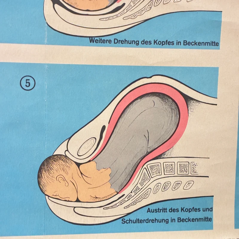 Vintage Schulkarte – Geburtsverlauf – Biologie Lehrtafel Rollbild Gebraucht