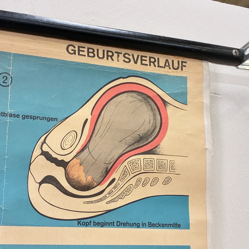 Vintage Schulkarte – Geburtsverlauf – Biologie Lehrtafel Rollbild Gebraucht